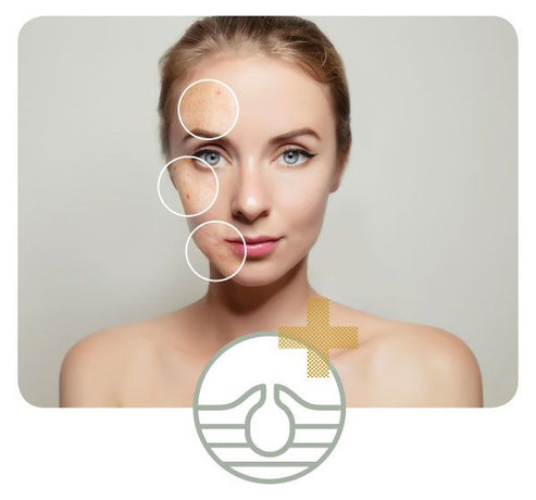 Gel anti imperfection de Manuka, huile de manuka, Aloe